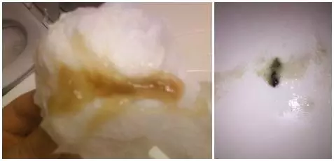 比赛鼻涕黄稠(鼻涕黄色粘稠鼻塞是什么原因)